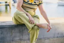 Quando indicar cirurgia de joanete