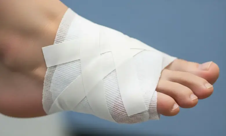 Quantos dias é a recuperação de cirurgia de joanete